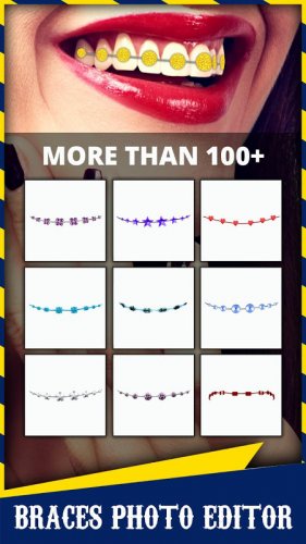 Braces 1 3 Download Android Apk Aptoide - roblox ugly braces face