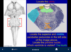 Neuroanatomy - SecondLook screenshot 4