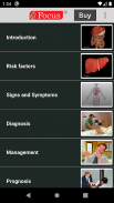 Alcoholic Liver Disease screenshot 3