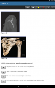 Orthopaedic Surgery Examination and Board Review screenshot 8