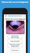 ReVision - Revisit Your Knowledge (Ophthalmology) screenshot 6