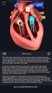 Heart Anatomy Pro. screenshot 8