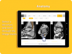 MRI Essentials screenshot 1