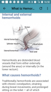 Hemorrhoid & Treatment screenshot 2