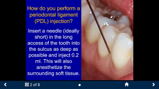 Dental Anesthesia - SecondLook screenshot 1