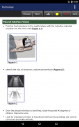 Pocket Atlas of Emergency Ultrasound, 2nd Edition screenshot 23