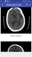 CT Brain Interpretation screenshot 4