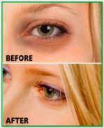 Dark Circles Tips screenshot 0