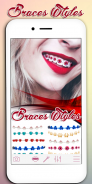 Braces Photo Editor screenshot 0