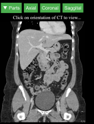 Radiology CT Viewer screenshot 6