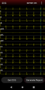 ECG Connect screenshot 2