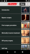 Coronary Artery Bypass Graft screenshot 6