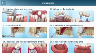 Dental 3D Illustrations screenshot 2