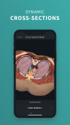 Complete Anatomy 19 for Android screenshot 5