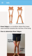Knock Knees Exercises screenshot 2