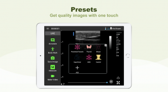 LELTEK Ultrasound - LeSono screenshot 0