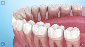 Dental 3D Illustrations screenshot 21