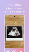エコー写真　スキャンして簡単整理！ screenshot 2