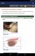 Pocket Atlas of Emergency Ultrasound, 2nd Edition screenshot 9