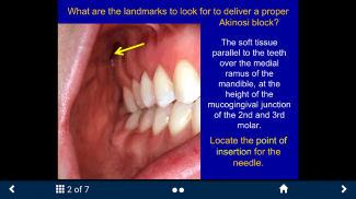 Dental Anesthesia - SecondLook screenshot 3