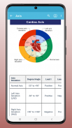 ECG EKG Interpretation Mastery screenshot 2