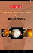 Ophthalmology- Dictionary screenshot 6