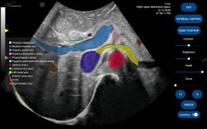 Scanbooster Ultrasound Sim screenshot 7