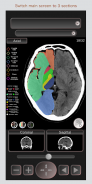 CT PassportLite Head/Brain MRI sectional anatomy screenshot 4