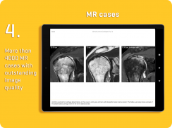 MRI Essentials screenshot 6
