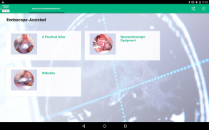 AESCULAP Neuroendoscopy screenshot 0