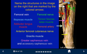 MSK Anatomy - SecondLook screenshot 4