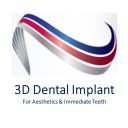 3D Dental Implant