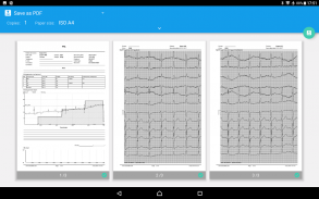 DiaCard - ECG Recorder screenshot 9