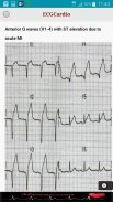 ECGCardio screenshot 11