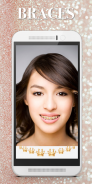 Braces Photo Editor - Beauty editor screenshot 6