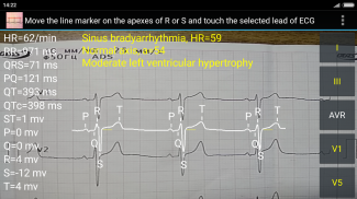 ECG Reader2 free screenshot 2