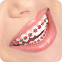 Braces Photo - Baixar APK para Android | Aptoide