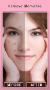 Face Blemish Remover - Smooth Skin & Beautify Face screenshot 0
