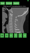 CT Cervical Spine screenshot 5