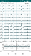DiaCard - ECG Recorder screenshot 18