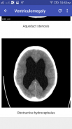 CT Brain Interpretation screenshot 3