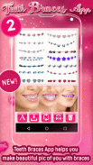 Teeth Braces App 2 screenshot 5