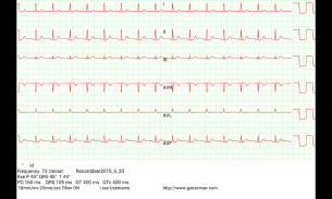 Mobile patient monitoring screenshot 0