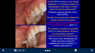 Dental Anesthesia - SecondLook screenshot 2