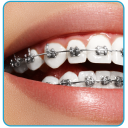 Braces Photo Editor - Beauty editor Icon