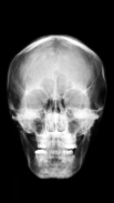 Röntgenscanner Prank screenshot 1