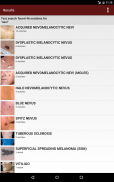 Fitzpatrick's Derm Flash Cards screenshot 6