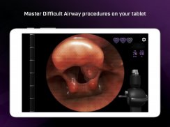 Airway Ex - Intubate. Anesthetize. Train. screenshot 17