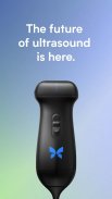 Butterfly iQ — Ultrasound screenshot 0