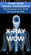 X-RAY WOW screenshot 0